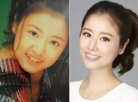 明星牙齿对比照,见证美丽笑容的神奇魔力